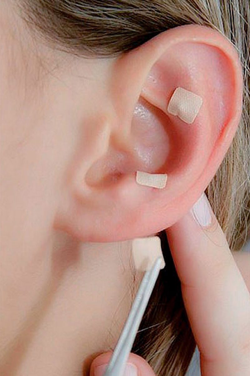 Biovida-Auriculoterapia